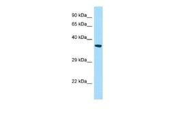 START domain containing 7 Antibody, Novus Biologicals 100 &mu;L; Unconjugated:Antibodies,